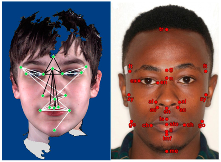 rasgos faciales en le autismo