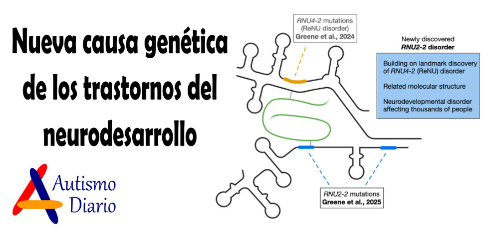 Nueva causa genética de los trastornos del neurodesarrollo
